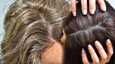 cheveux blancs comment regler probleme